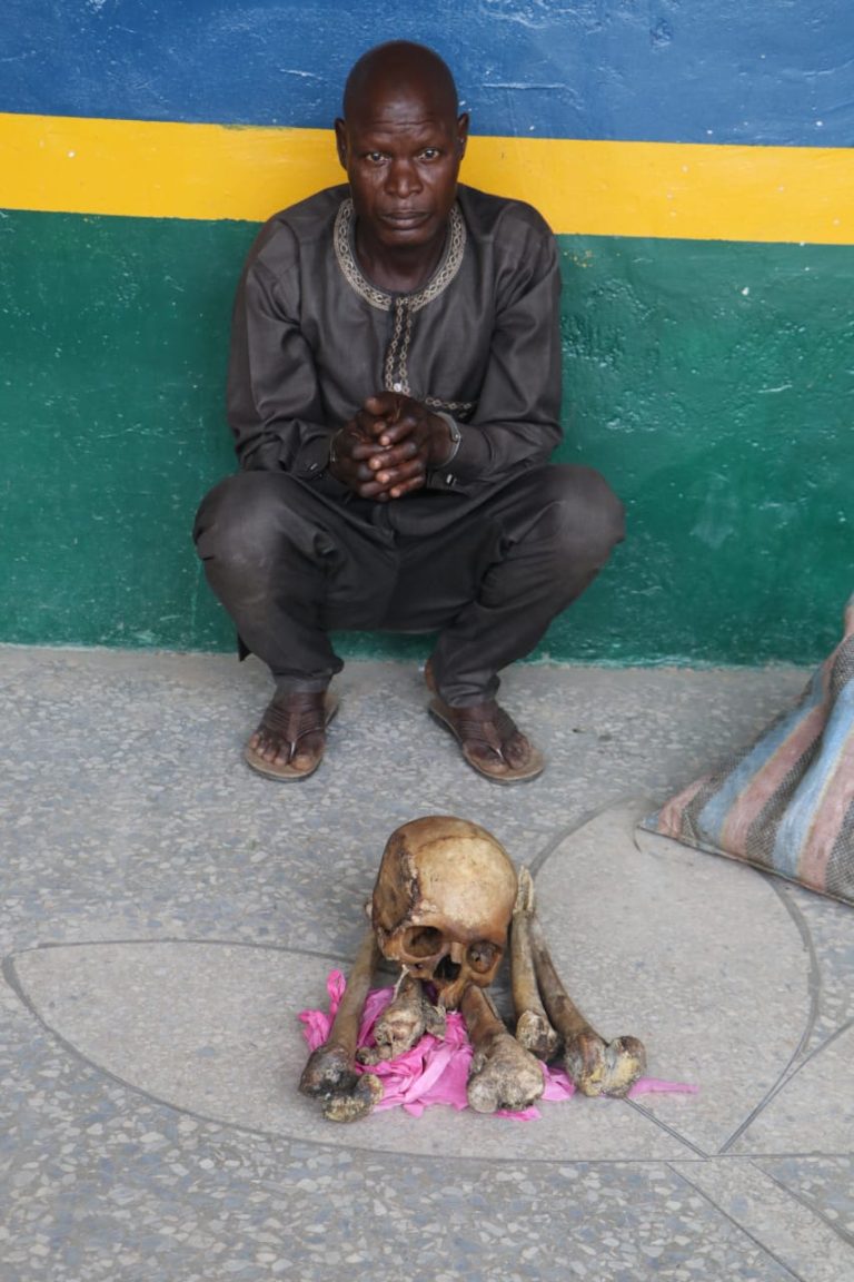 Police arrest man with human parts in Abuja
